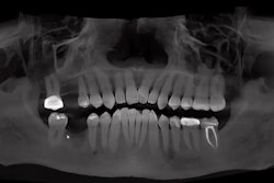 Using CBCT for better case presentation