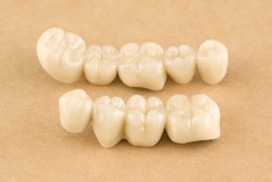 Dental Bridge Aliaksei Luskin