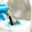 Plasma Rich Protein Prp Johann Heldebrand