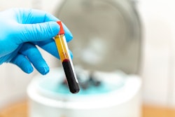Plasma Rich Protein Prp Johann Heldebrand