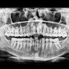 Xray Sinus Msc