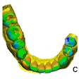 2025 05 03 3 D Printed Restorations 400