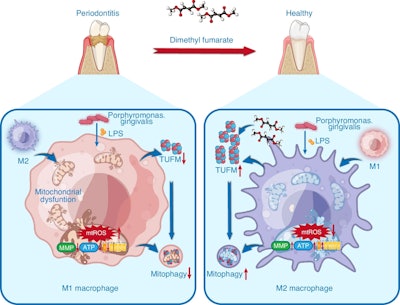 Schematic diagram for the beneficial effects of dimethyl fumarate against periodontitis through the regulation of TUFM-dependent mitophagy. Images and captions courtesy of Huang et al. Licensed under CC-BY-4.0.