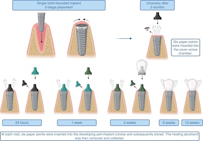 An illustration of the clinical study's design. Image and captions courtesy of Kumar et al. Licensed under CC BY 4.0.
