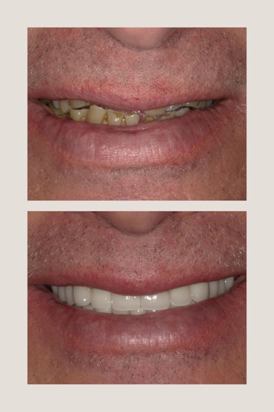 Images courtesy of Dr. Ankur Gupta.