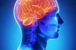 Brain General