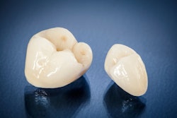 Dental Crowns