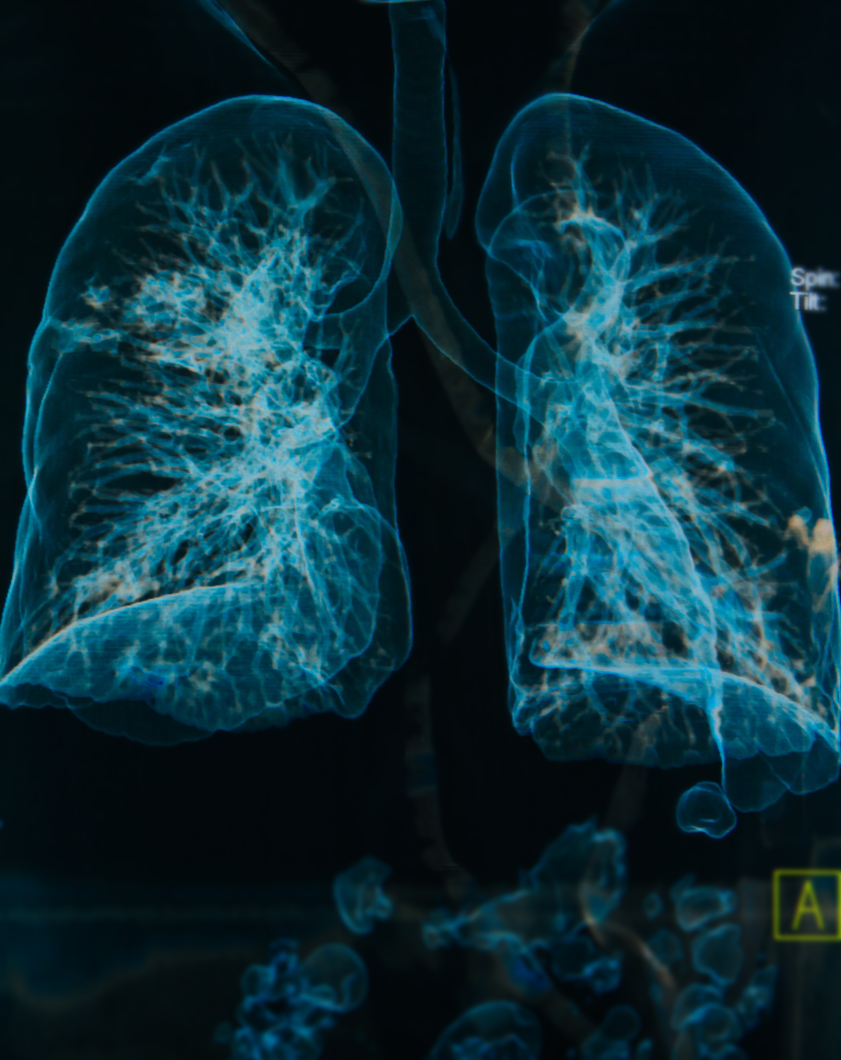 Lung 3 D