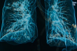 Lung 3 D