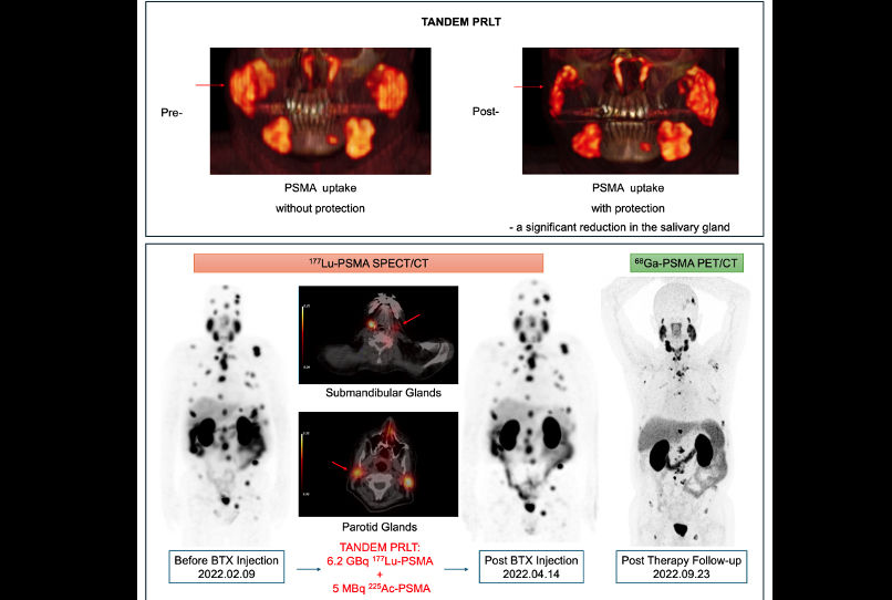 2025 06 24 Dual Approach Mmrpc Thumbnail