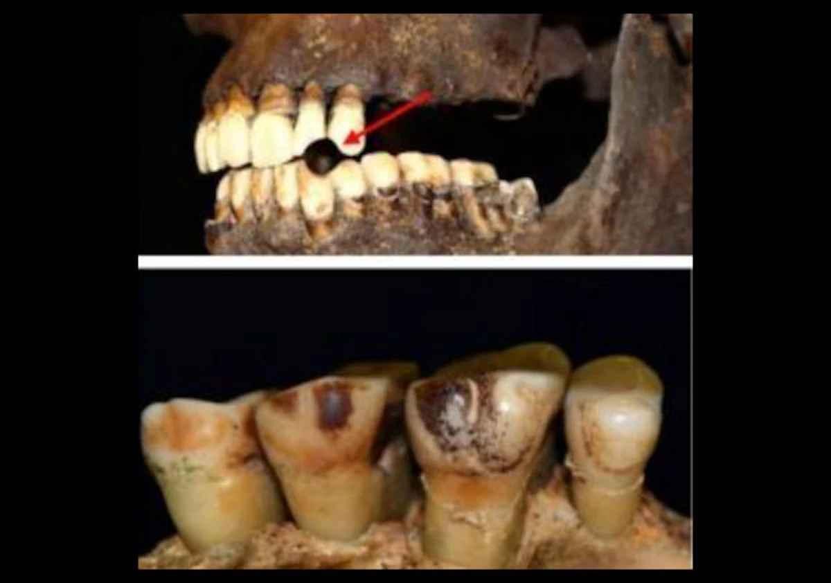 why is chewing tobacco addictive 5 Things You Need to Know About Chew