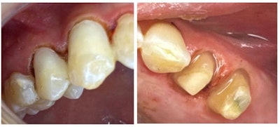 2025 07 Catapult Riva Lc Figs 3 4