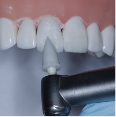 Figure 2: The ShofuOne Gloss Point that was used to create lobes.