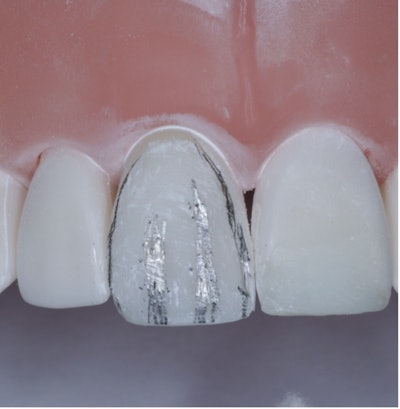 Figure 1: Creating lobes and depressions.