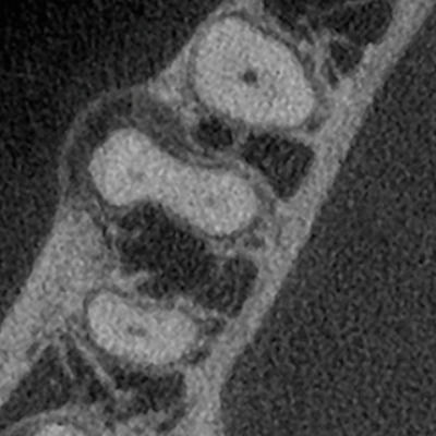 2025 07 17 Endo Cs Fig2 400