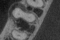 2025 07 17 Endo Cs Fig2 400