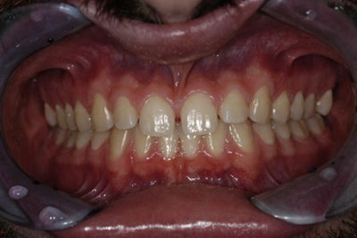 Figure 2: Close-up of retracted facial view (pre-op).