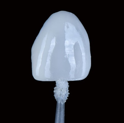 Figure 10: Facial surfaces of the veneers coated with Kuraray Majesty ES Flow to enhance gloss retention.