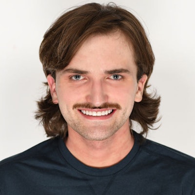 Figure 13: Post-op smile.