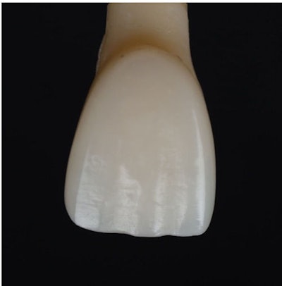 Figure 4: A polished tooth.