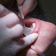 Dental Unit Waterline