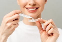 Woman Teeth Whitening Aleksandr Rybalko