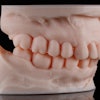 3 D Dental Model Dental Pro Content