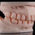3 D Dental Model Dental Pro Content