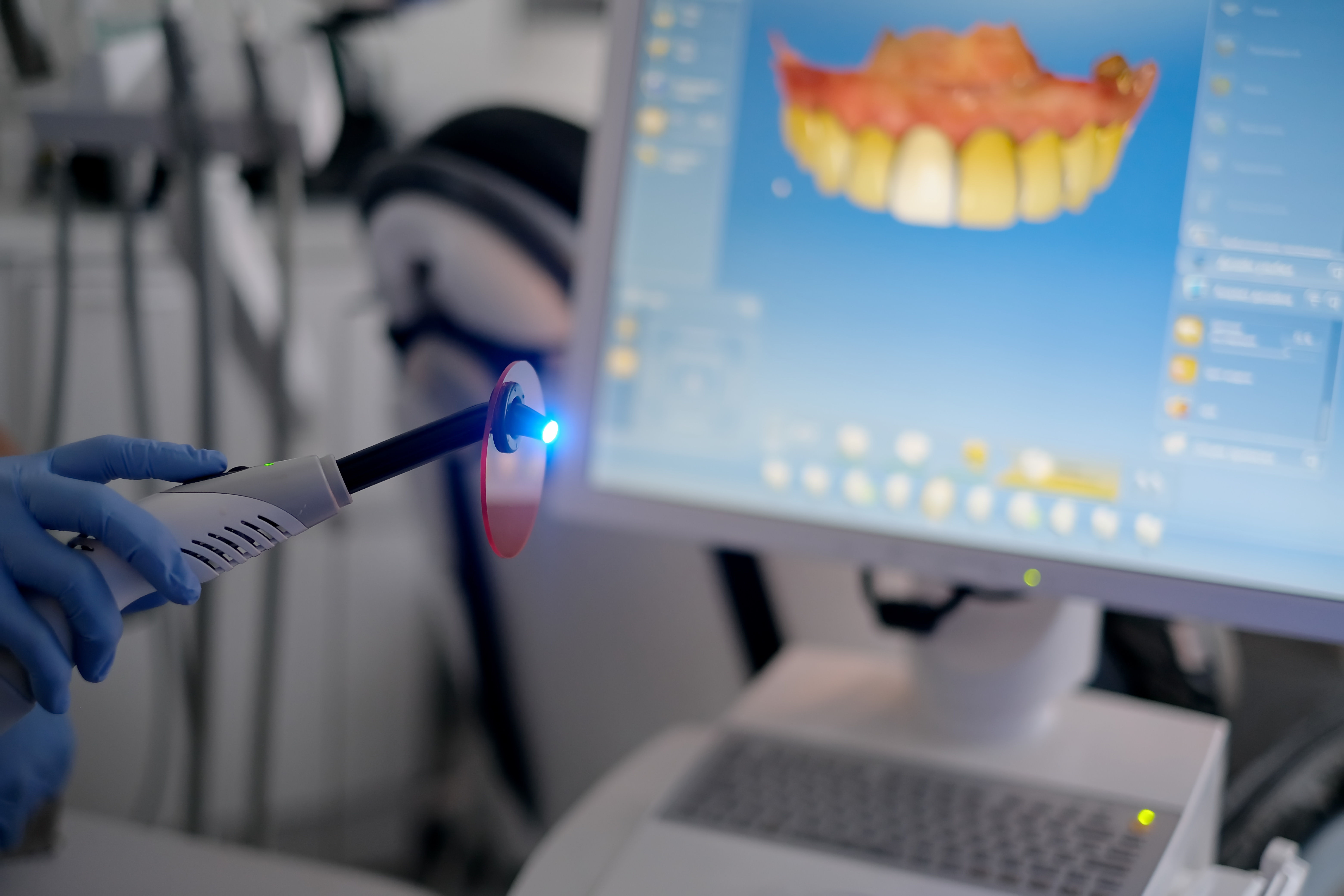 Curing Light Cerec Zulaykhat