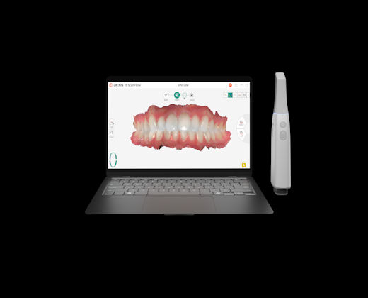 2025 09 16 Dexis Imprevo 400