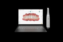 2025 09 16 Dexis Imprevo 400