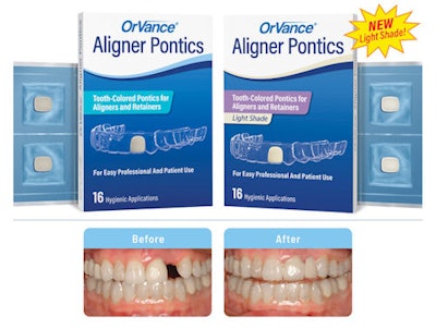 OrVance Aligner Pontics.