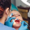 Child Fluoride Application