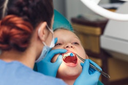 Child Fluoride Application