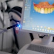 Curing Light Cerec Zulaykhat