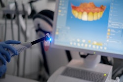 Curing Light Cerec Zulaykhat