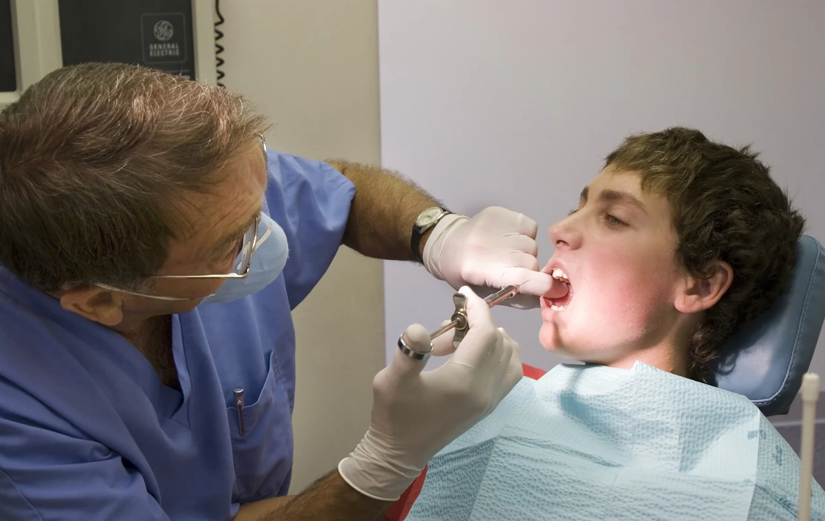 What you need to know about buccal infiltration with articaine ...