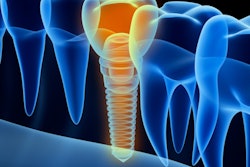 Implant 3 D 400