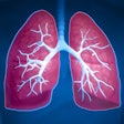 Lung General 400