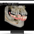 2025 10 23 Carestream Imaging Premium 400