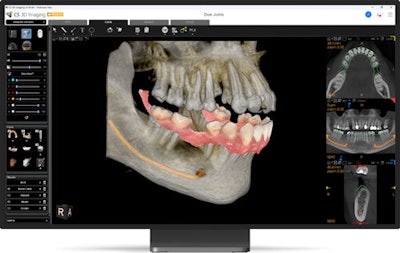 The CS 3D Imaging Premium software solution.