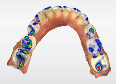 Figure 6: Full-arch digital verification.