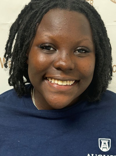 Figure 11b-11: Final restoration of tooth #9.