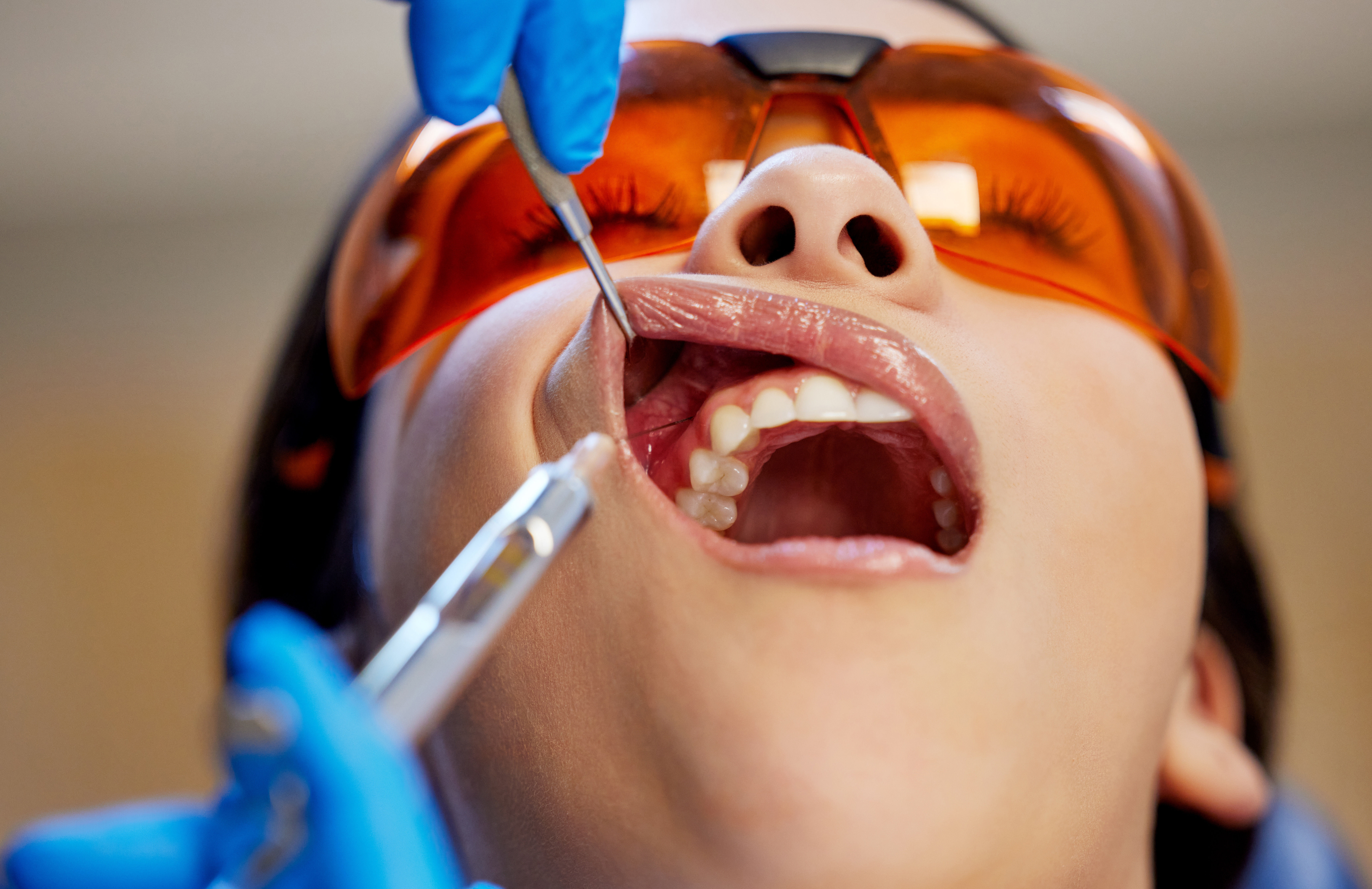 Dental Anesthesia Injection Lumeez23 Peopleimagescom