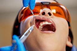 Dental Anesthesia Injection Lumeez23 Peopleimagescom