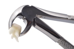 Dental Forceps Tooth