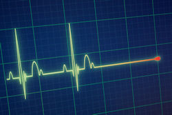 Ekg Death Portokalis 400