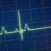 Ekg Death Portokalis 400