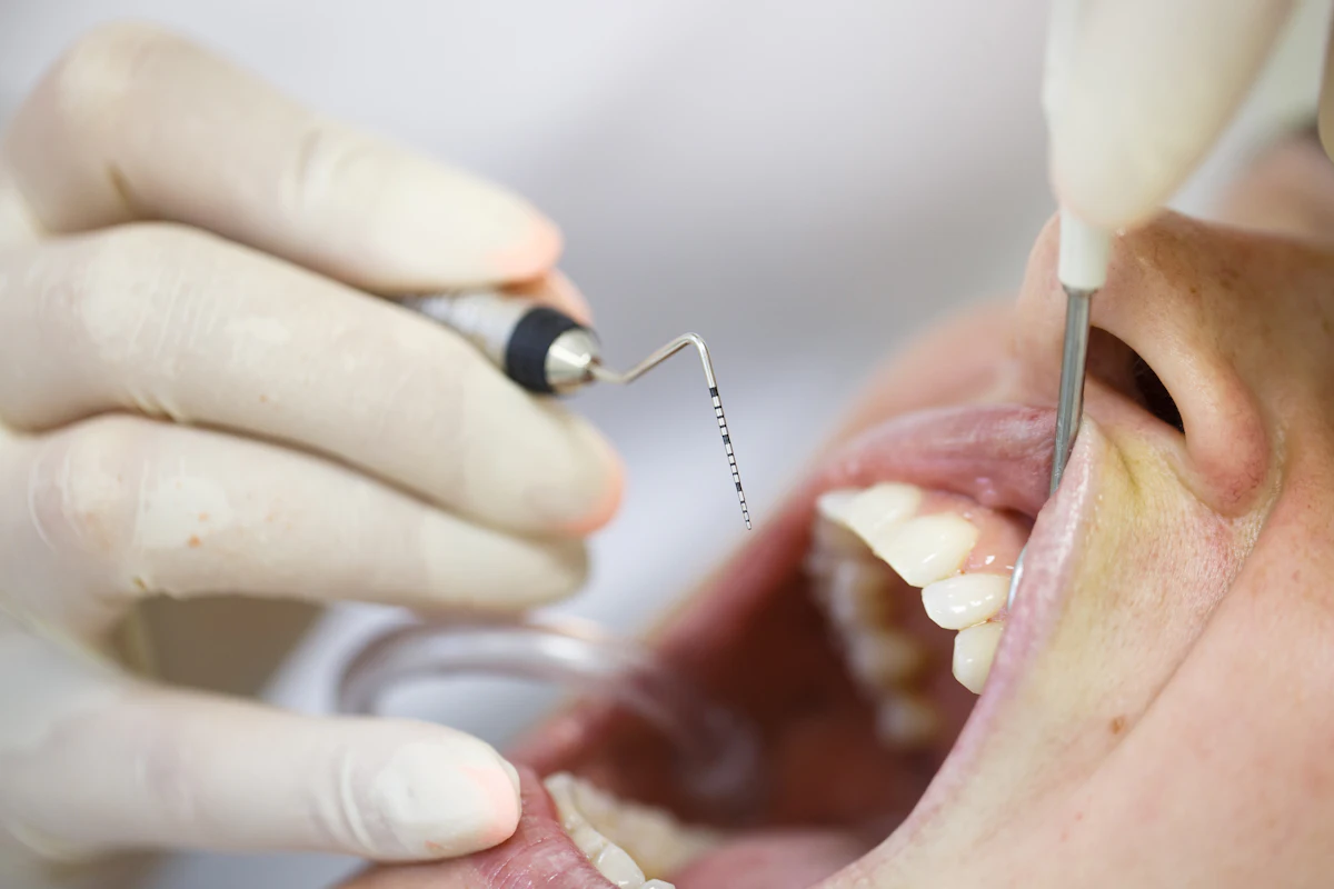 Using dental endoscopy to transform periodontal care Using dental endoscopy to transform periodontal care