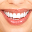 Smile3